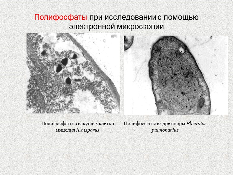 Полифосфаты при исследовании с помощью электронной микроскопии